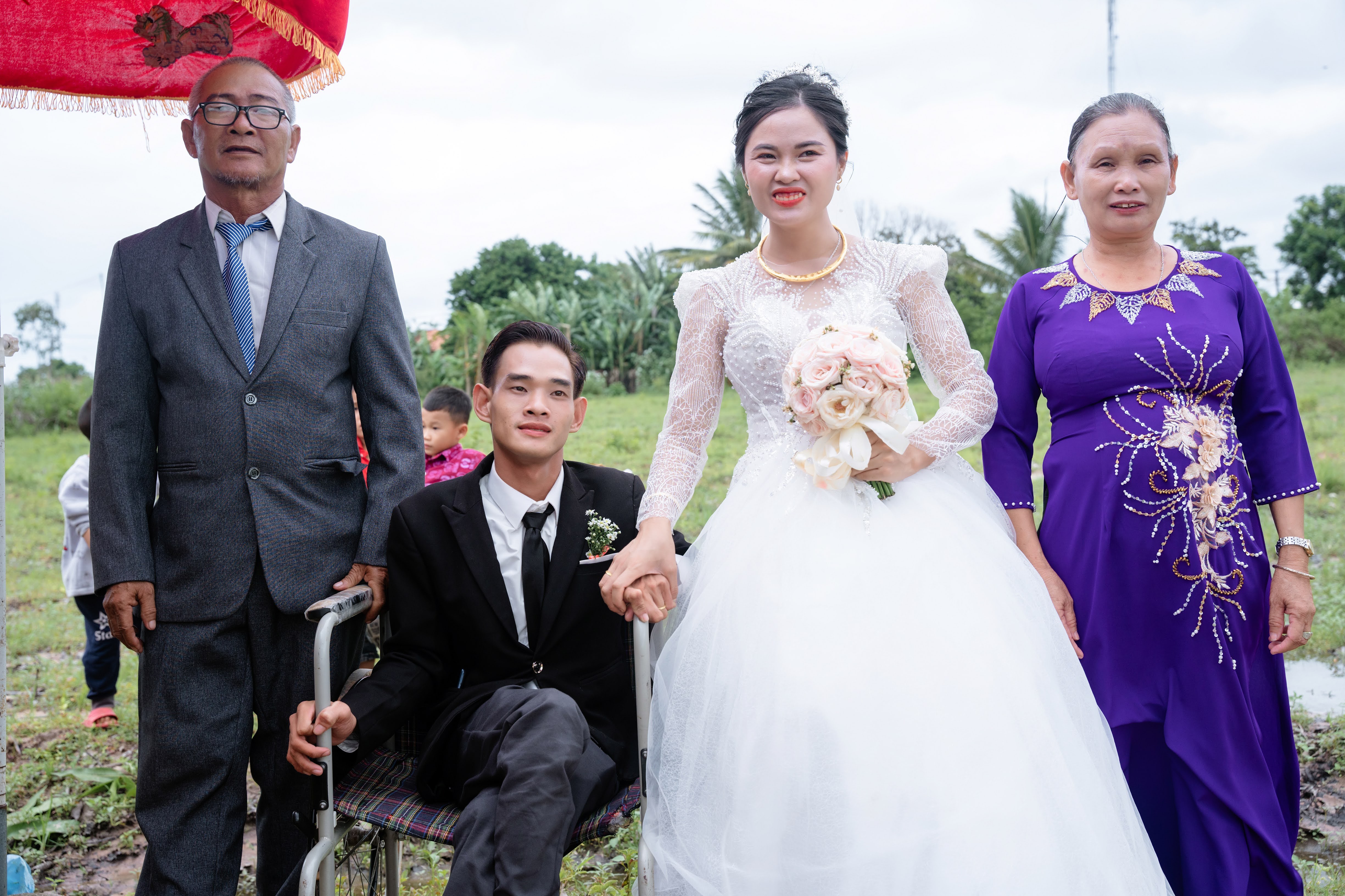 Dân sinh - Những điều kỳ lạ của chàng trai khuyết tật đôi chân (Hình 6).