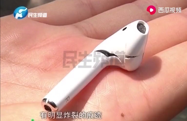 Cộng đồng mạng - Nhập viện cấp cứu vì tai nghe Airpods phát nổ khi đang đeo trên tai