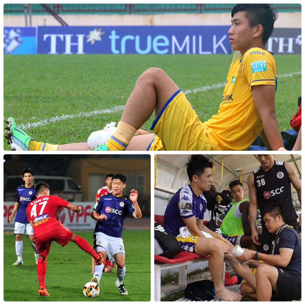Thể thao - Trước thềm các trận bóng 'long tranh hổ đấu': Nỗi ám ảnh chấn thương của cầu thủ Việt Nam