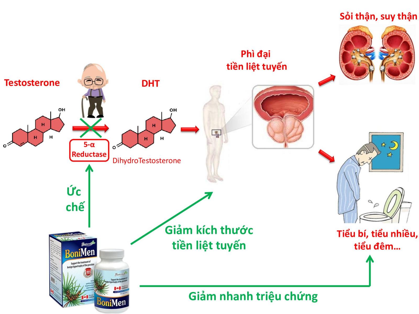 Sức khỏe - BoniMen – Ân nhân giúp tôi chiến thắng bệnh phì đại tuyến tiền liệt (Hình 3).