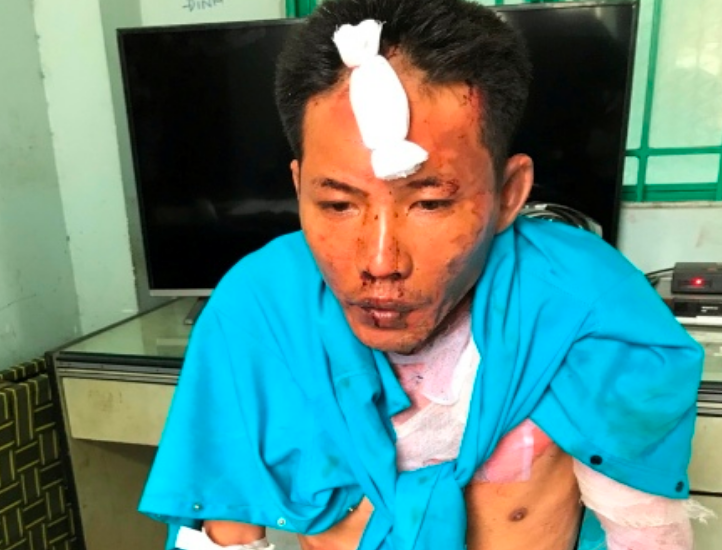 An ninh - Hình sự - Vụ 3 mẹ con bị tưới xăng thiêu sống ở Đồng Nai: 2 cháu bé tử vong