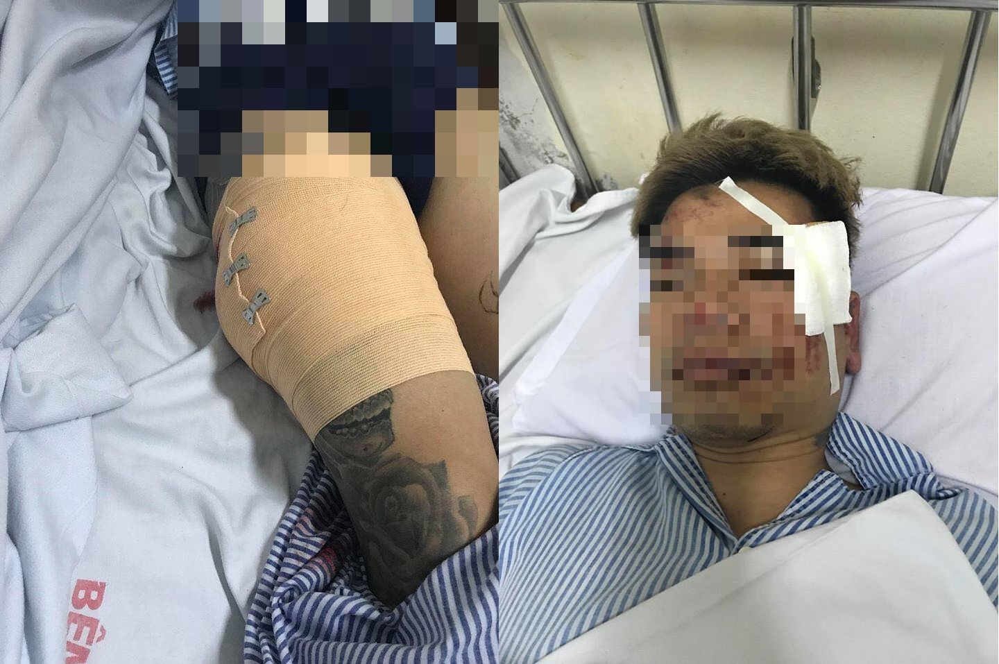 Hà Nội: Điều tra nhóm côn đồ nghi dùng súng bắn gục nạn nhân (Hình 2).