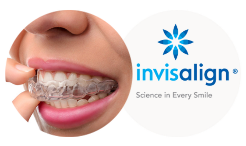 Truyền thông - Chỉnh nha Invisalign – niềng răng vô hình, hoàn thiện nụ cười (Hình 2).