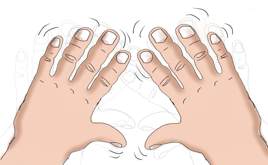 Sức khỏe - Đ&ocirc;ng dược gi&uacute;p người bệnh run tay lấy lại tự tin trong cuộc sống