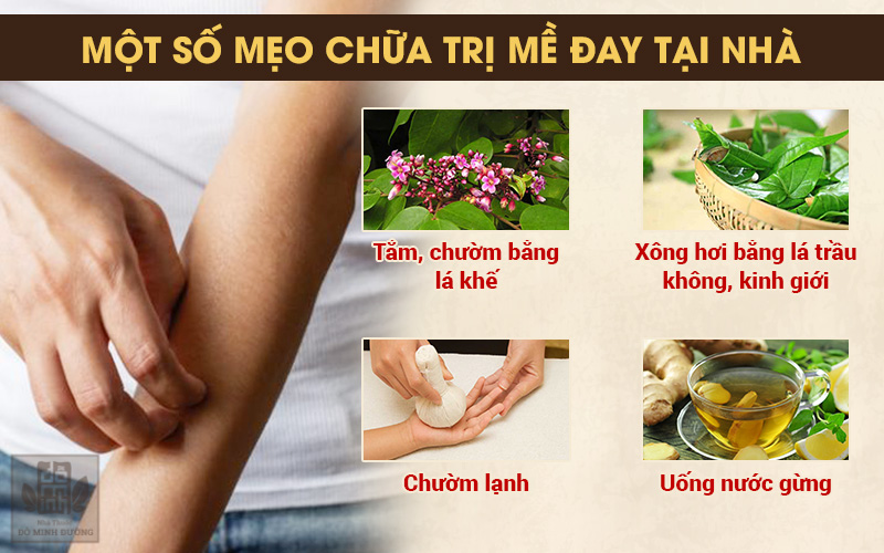 Truyền thông - Bác sĩ Tùng Lâm dòng họ Đỗ Minh chỉ cách dùng bài thuốc chữa nổi mề đay tại nhà