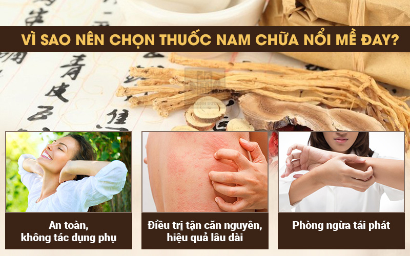 Truyền thông - Bác sĩ Tùng Lâm dòng họ Đỗ Minh chỉ cách dùng bài thuốc chữa nổi mề đay tại nhà (Hình 2).