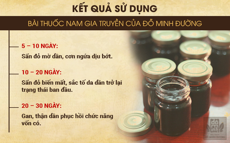 Truyền thông - Bác sĩ Tùng Lâm dòng họ Đỗ Minh chỉ cách dùng bài thuốc chữa nổi mề đay tại nhà (Hình 6).