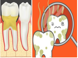 Sức khỏe - Bỏ túi ngay các mẹo hay trị hôi miệng (Hình 2).