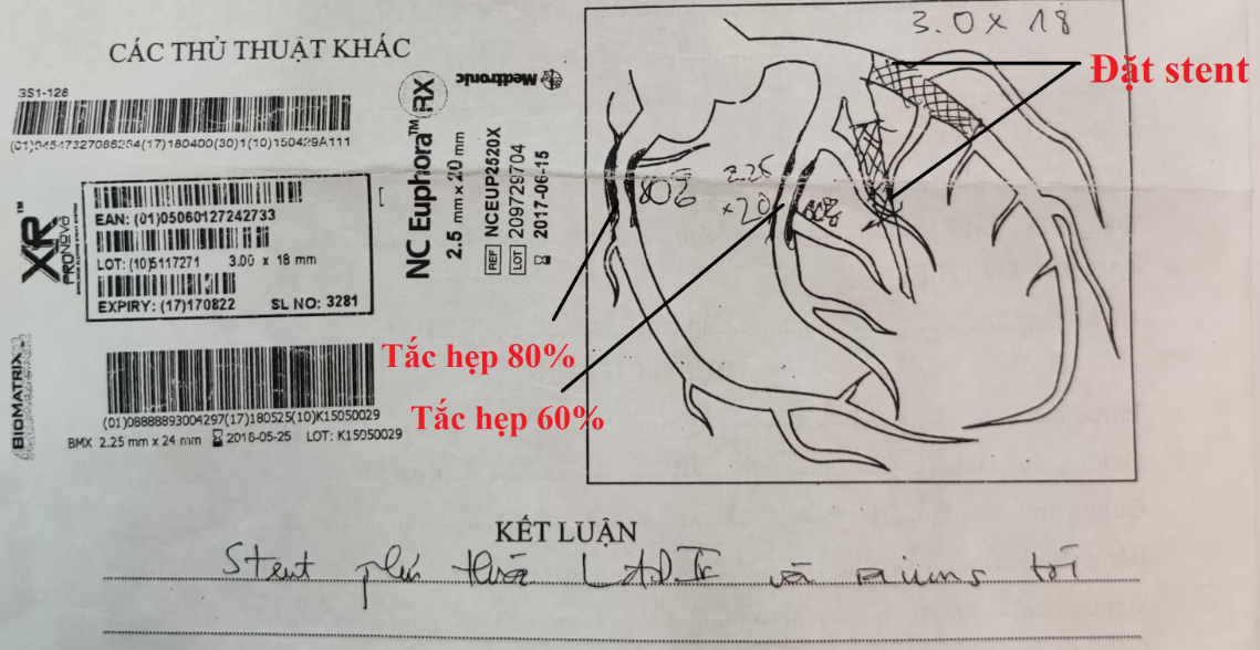 Sức khỏe - Nhồi máu cơ tim do nghẽn mạch vành, sau đó là suy tim, tôi không ngỡ mình lại gượng dậy được như thế (Hình 2).