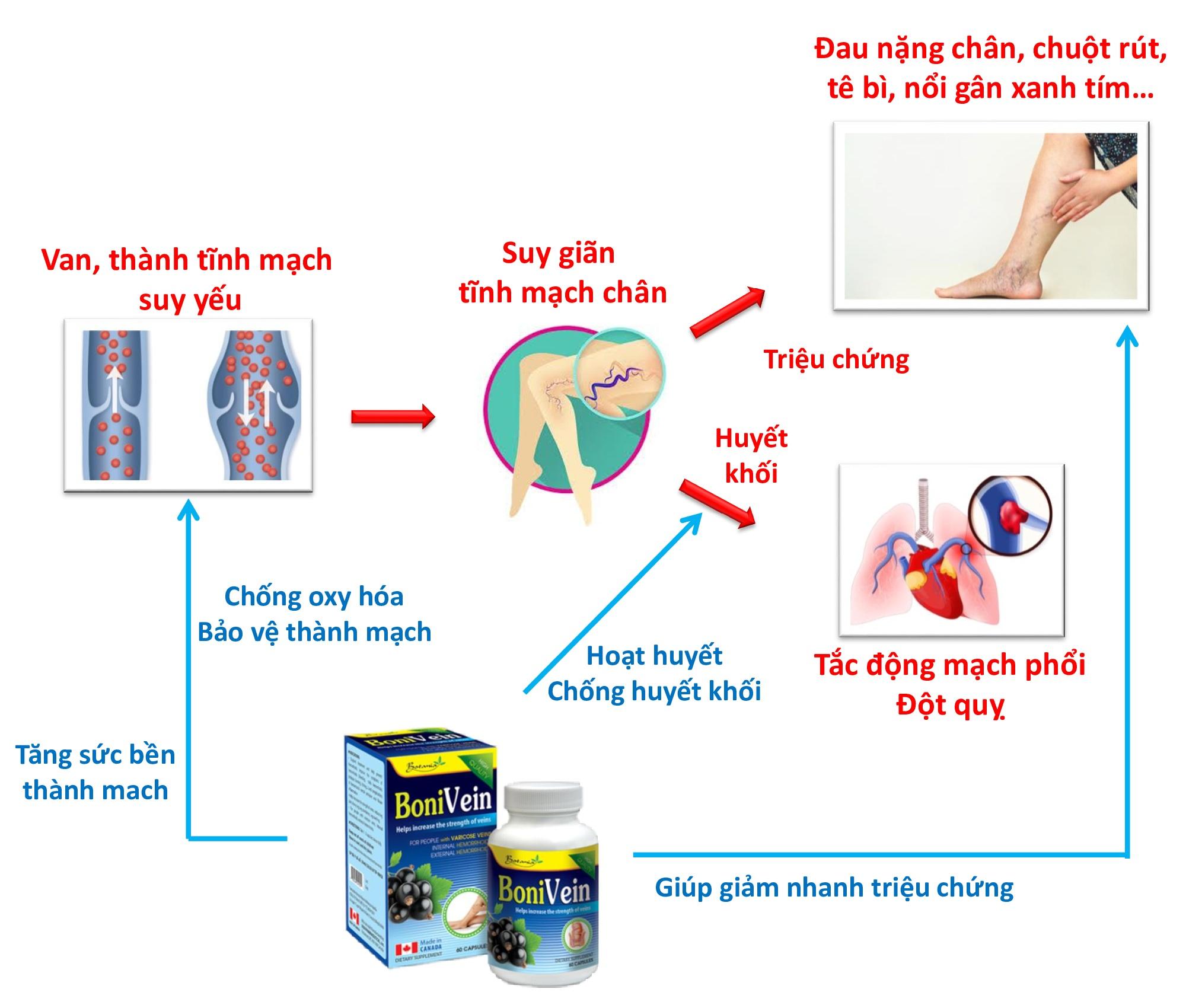 Sức khỏe - BoniVein – Ân nhân giúp tôi thoát khỏi bệnh suy giãn tĩnh mạch (Hình 3).