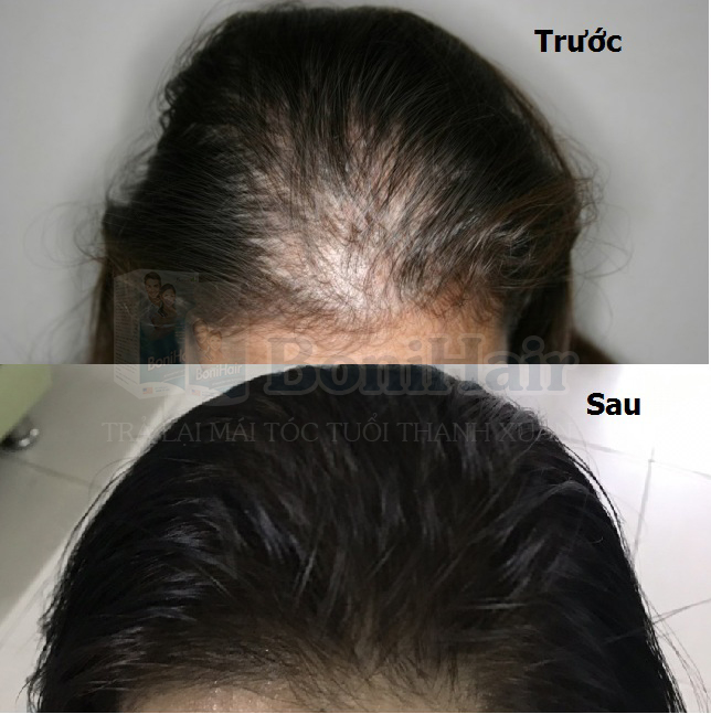 Sức khỏe - BoniHair – Bí quyết cho mái tóc đen dày bất chấp tuổi tác (Hình 2).