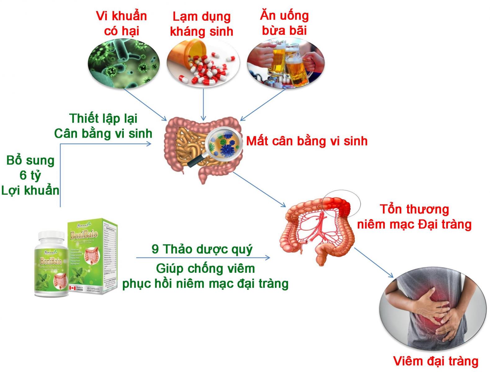 Sức khỏe - BoniBaio – Bảo bối giúp tôi chiến thắng ngoạn mục viêm đại tràng  (Hình 3).