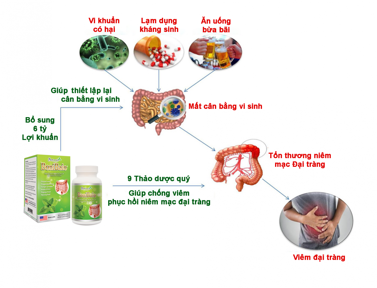 Sức khỏe - BoniBaio –Bí kíp “đánh bại” viêm đại tràng & hội chứng ruột kích thích (Hình 2).