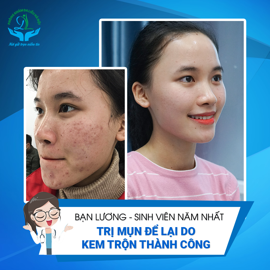 Cần biết - Phòng khám Da liễu Hà Nội – Uy tín, chất lượng hàng đầu (Hình 4).