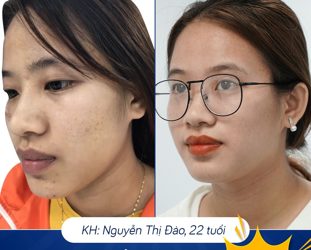 Cần biết - Phòng khám Da liễu Hà Nội – Uy tín, chất lượng hàng đầu (Hình 5).