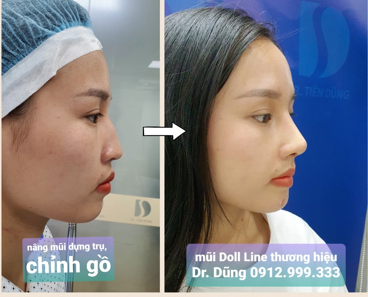 Cần biết - Đỗ Tiến Dũng: Người tìm lại nhan sắc cho phụ nữ gặp tai nạn thẩm mỹ (Hình 4).