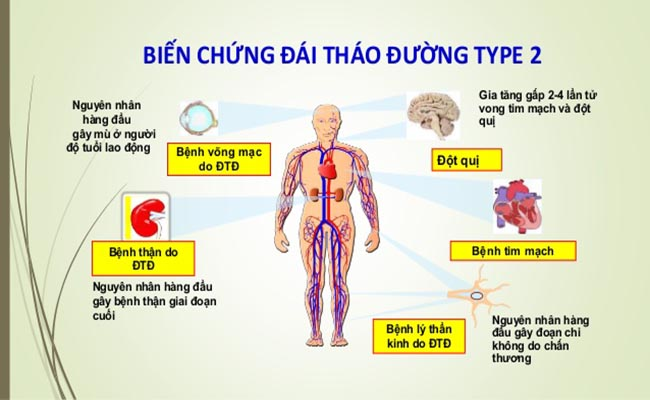 Cần biết - Cảnh báo biến chứng nguy hiểm của bệnh tiểu đường (Hình 2).