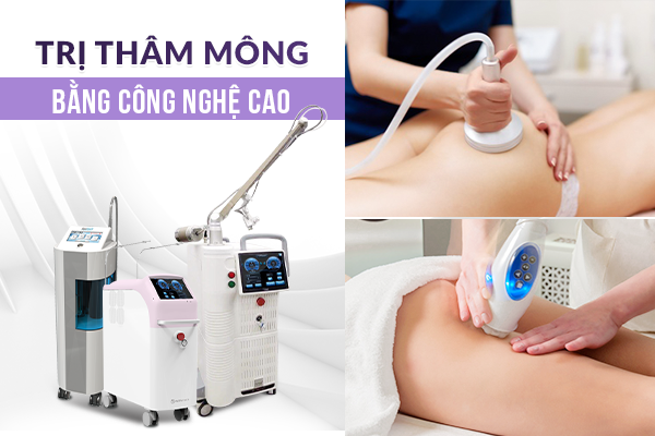 Cần biết - Trị thâm mông đùi bẹn nhanh chóng với laser công nghệ cao - Xu hướng thẩm mỹ hè 2022 (Hình 4).