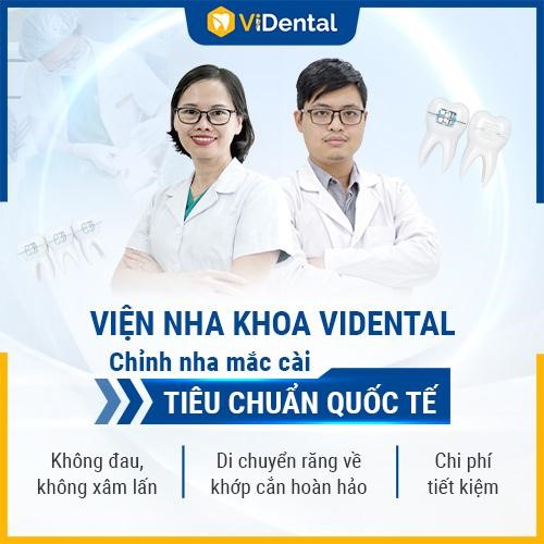 Cần biết - Niềng Răng Trả Góp Lãi Suất 0% tại ViDental: Cam Kết Bảo Hành TRỌN ĐỜI (Hình 2).