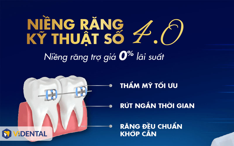 Cần biết - Niềng Răng Trả Góp Lãi Suất 0% tại ViDental: Cam Kết Bảo Hành TRỌN ĐỜI (Hình 4).