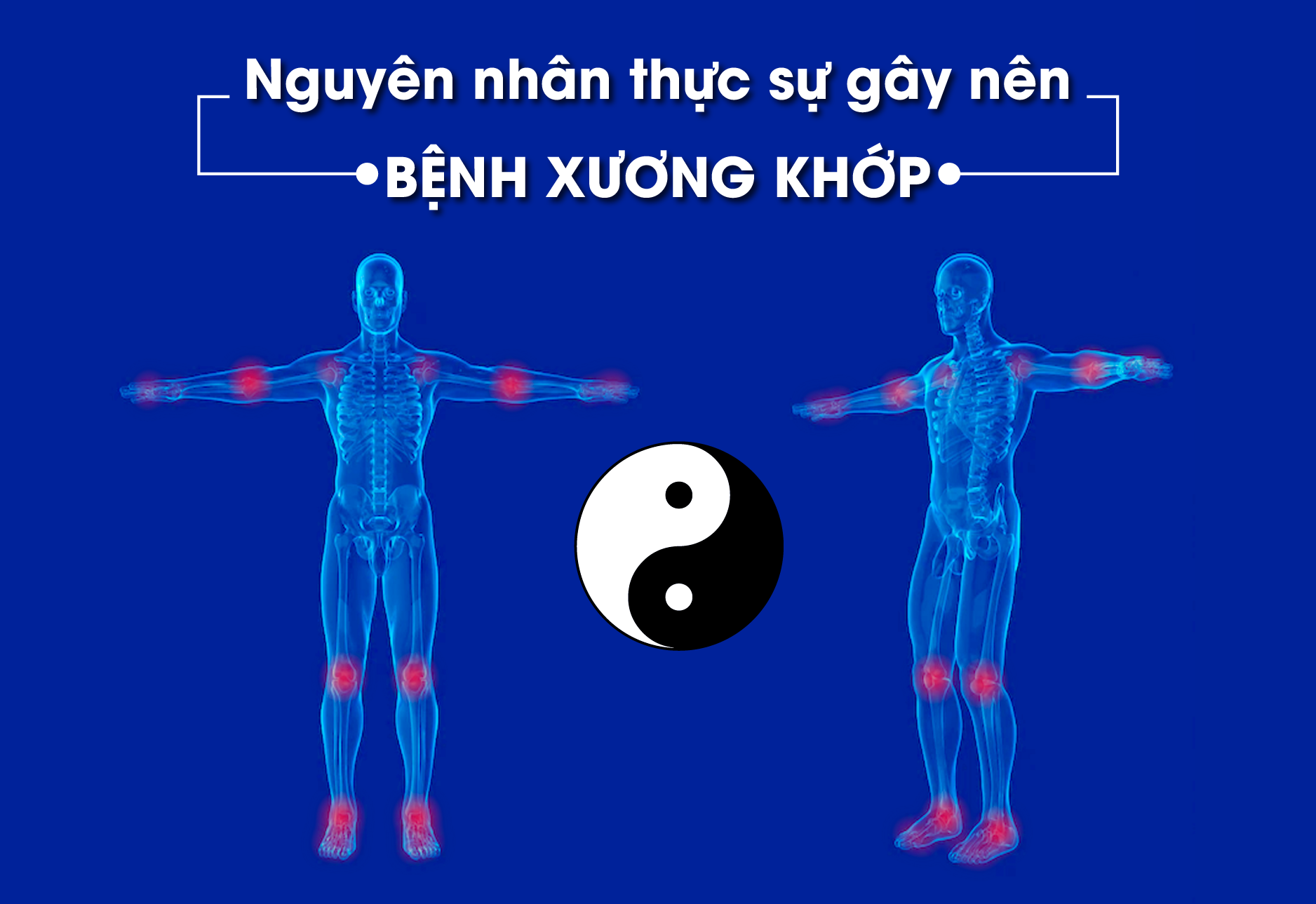 Cần biết - Không còn nỗi lo bệnh xương khớp nhờ bài thuốc quý Ngự y mật phương (Hình 2).