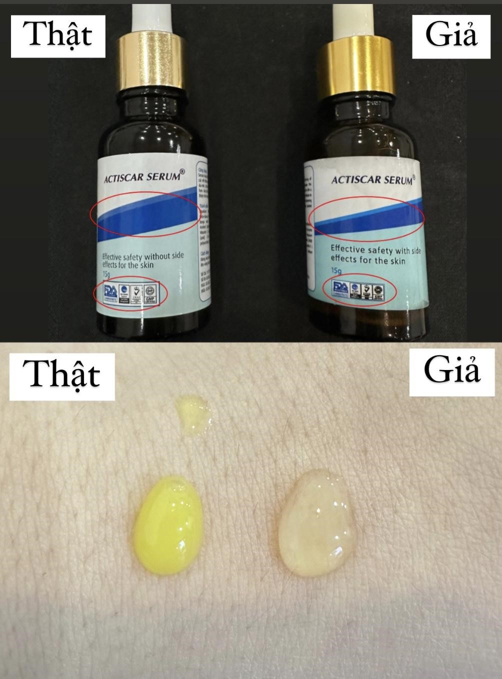 Cần biết - Actiscar cảnh b&aacute;o h&agrave;ng giả v&agrave; c&aacute;ch ph&acirc;n biệt sản phẩm ch&iacute;nh h&atilde;ng (H&igrave;nh 6).
