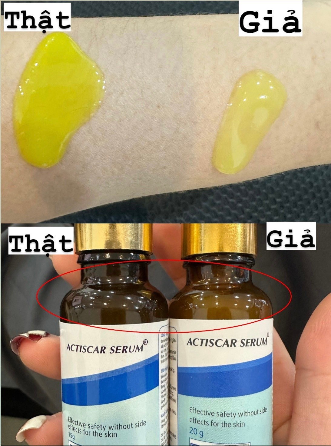 Cần biết - Actiscar cảnh b&aacute;o h&agrave;ng giả v&agrave; c&aacute;ch ph&acirc;n biệt sản phẩm ch&iacute;nh h&atilde;ng (H&igrave;nh 3).