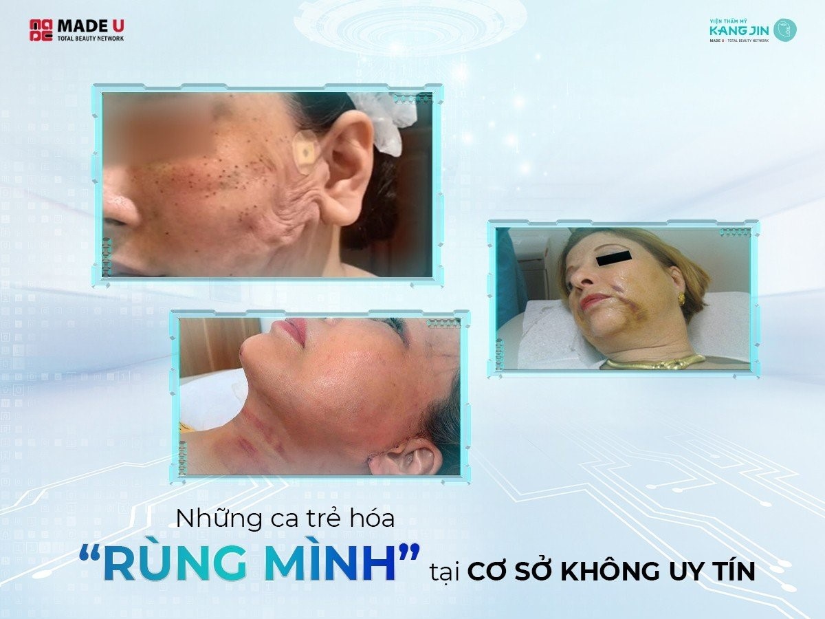 Đời sống - Viện thẩm mỹ KangJin - Lựa chọn uy tín giữa “ma trận” trẻ hóa