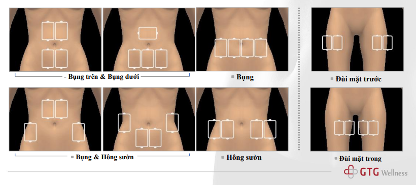 Cần biết - Thiết bị hỗ trợ săn chắc da không xâm lấn của Americare Clinic là gì? Người dùng đã thực sự hiểu? (Hình 4).