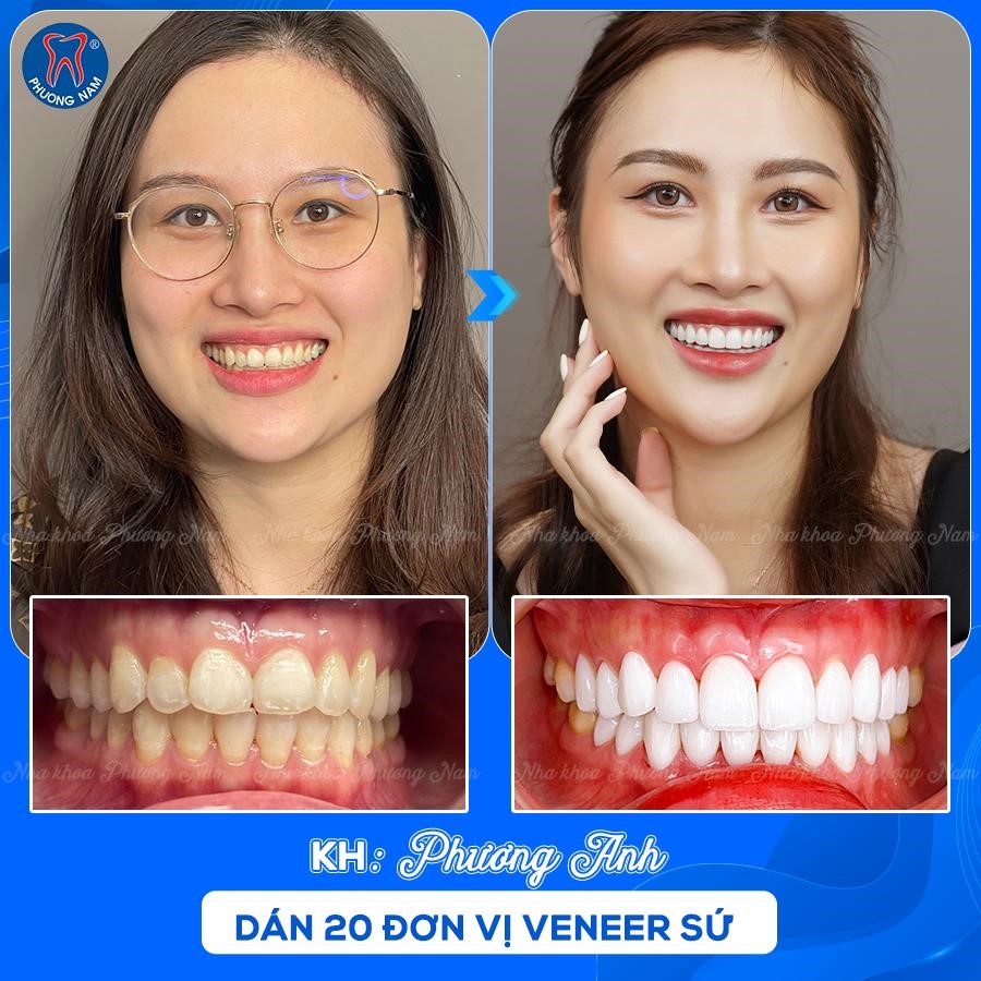 Cần biết - Bác sĩ Ngô Tùng Phương và đam mê bảo tồn răng gốc cho nụ cười hoàn hảo (Hình 3).