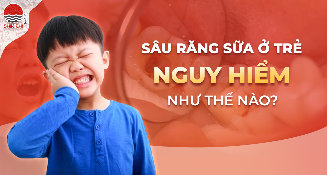 Cần biết - Sâu răng sữa ở trẻ nguy hiểm đến mức nào?