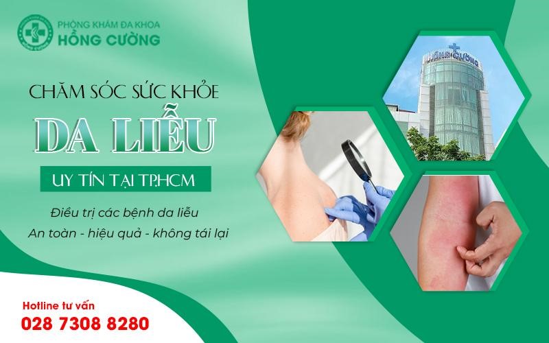 Cần biết - Chữa viêm da cơ địa hiệu quả ở Phòng khám da liễu Hồng Cường Tp.HCM