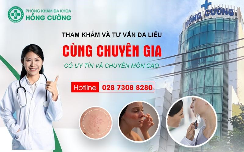 Cần biết - Chữa viêm da cơ địa hiệu quả ở Phòng khám da liễu Hồng Cường Tp.HCM (Hình 2).