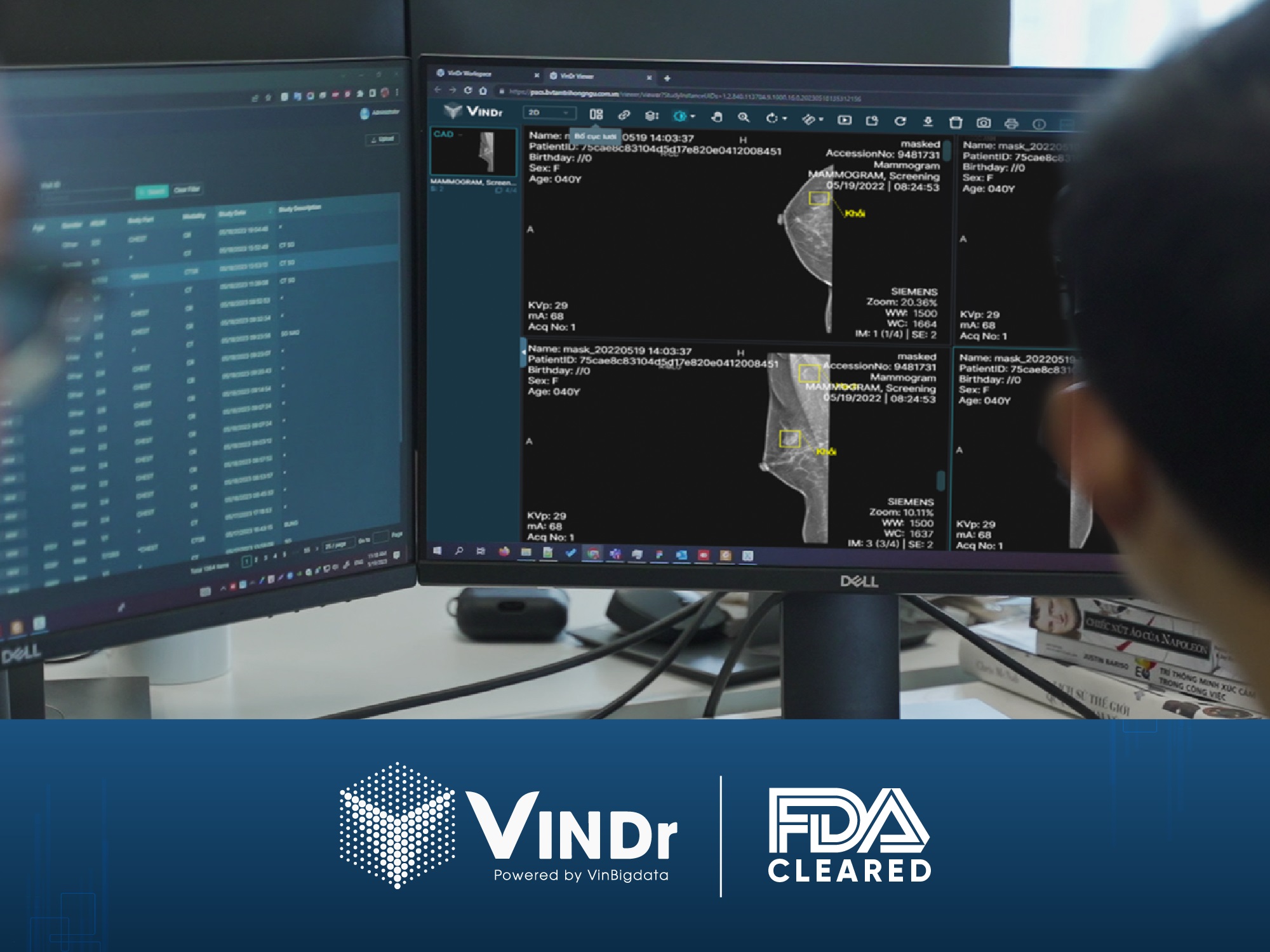 Kinh tế - TS Nguyễn Quý Hà: FDA mở ra cánh cửa cho VinBigdata chinh phục những thị trường hàng đầu thế giới (Hình 3).