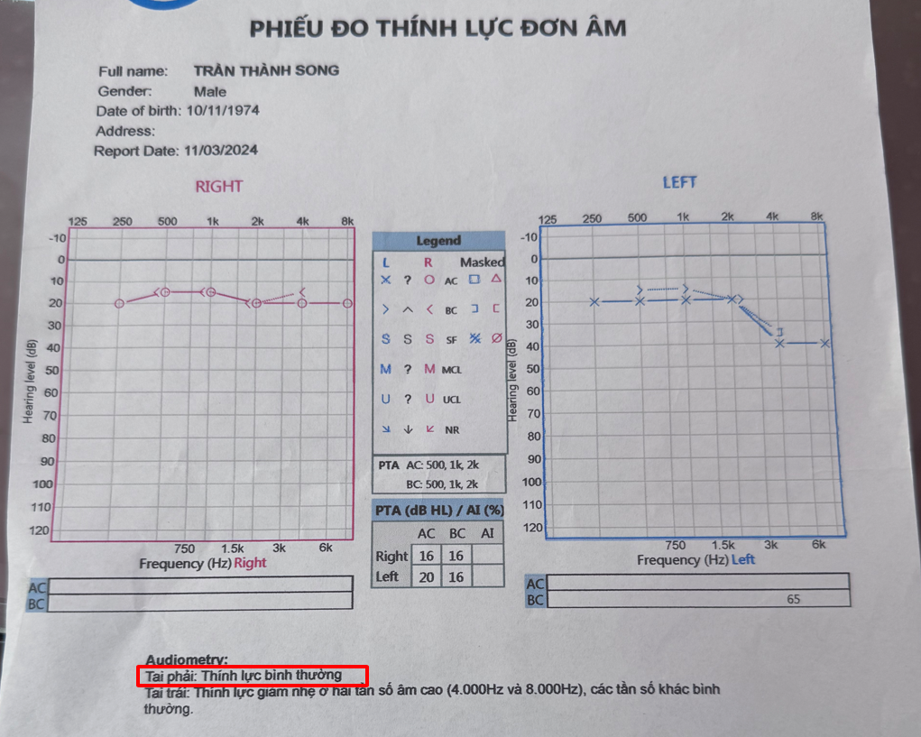 Sức khỏe -  Nhờ có Kim Thính anh Song đã cải thiện thính lực, không còn ù tai, nghe kém (Hình 4).