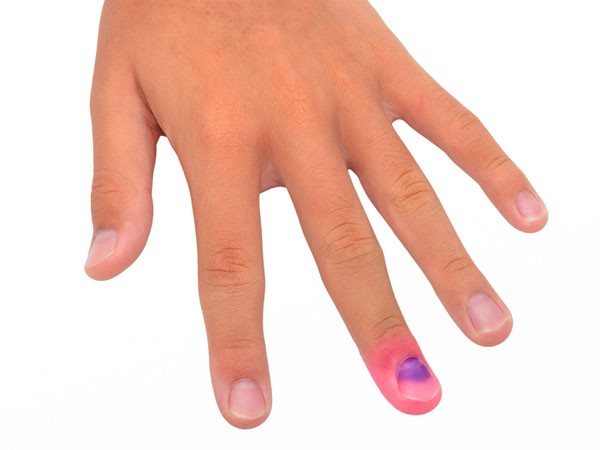 Đời sống - Bàn tay tiết lộ gì về sức khỏe? (Hình 5).