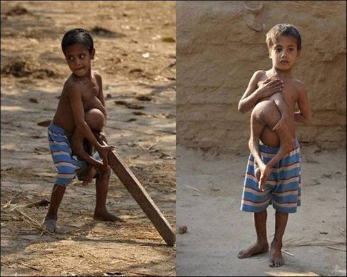 Technology - Strange boy with 4 arms and 4 legs is worshiped as a god of reincarnation