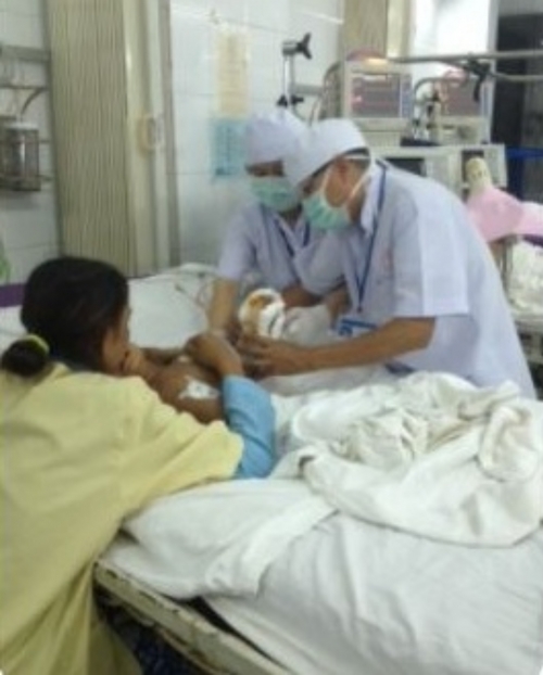 Đời sống - TP.HCM: Cứu th&agrave;nh c&ocirc;ng b&agrave;n tay bị đứt l&igrave;a của b&eacute; g&aacute;i 2 tuổi (H&igrave;nh 2).