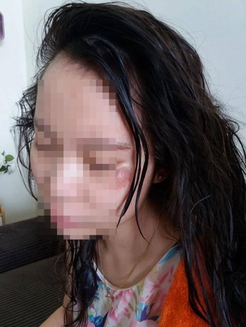 Pháp luật - Cô gái trẻ kể phút bị 2 tên cướp cởi trần giật túi, ngã xe bất tỉnh (Hình 2).