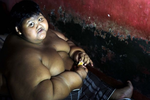 Đời sống - Cậu bé béo nhất thế giới kiệt sức vì chế độ ăn giảm cân khắc nghiệt (Hình 3).