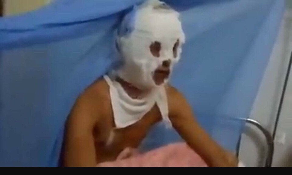 Ph&aacute;p luật - Qu&aacute; ngh&egrave;o 3 bố con bỏng nặng sắp bỏ viện về nh&agrave; v&igrave; hết tiền điều trị (H&igrave;nh 3).