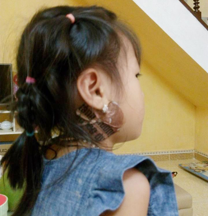 Đời sống - Kinh nghiệm chữa quai bị cho con chỉ 5 ngày không cần kiêng cữ