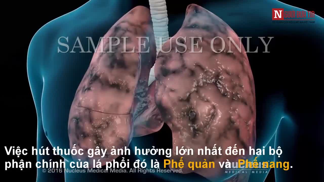 Video trực quan về quá trình tàn phá phổi của khói thuốc
