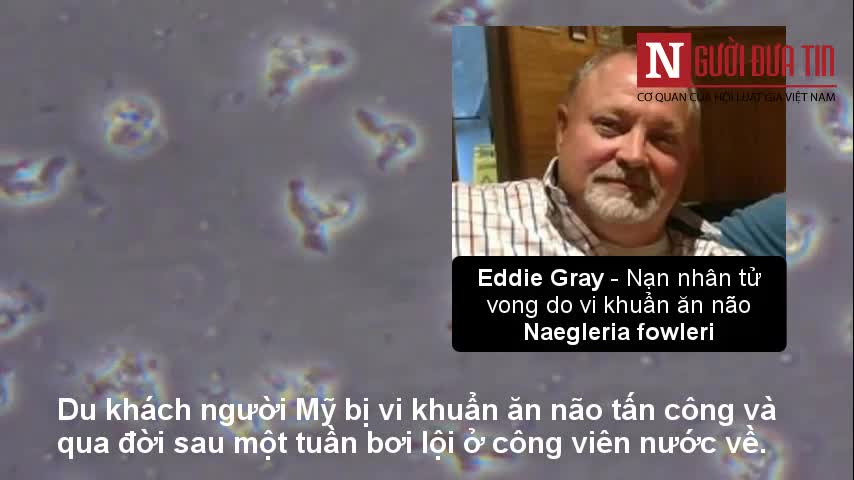 Nhiễm sinh vật “ăn não” khi bơi ở công viên nước, một du khách tử vong