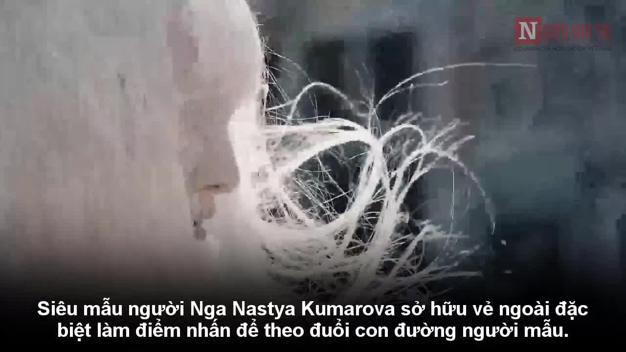 Gặp gỡ siêu mẫu bạch tạng với nhan sắc khiến ai cũng phải ngước nhìn