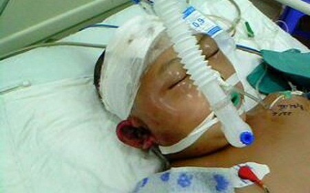 Pháp luật - Tan nát cõi lòng vì con bị kẻ tâm thần đánh vỡ đầu