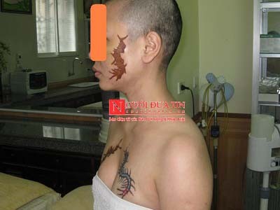 Pháp luật - Kết luận điều tra vụ cô gái bị xăm quái vật