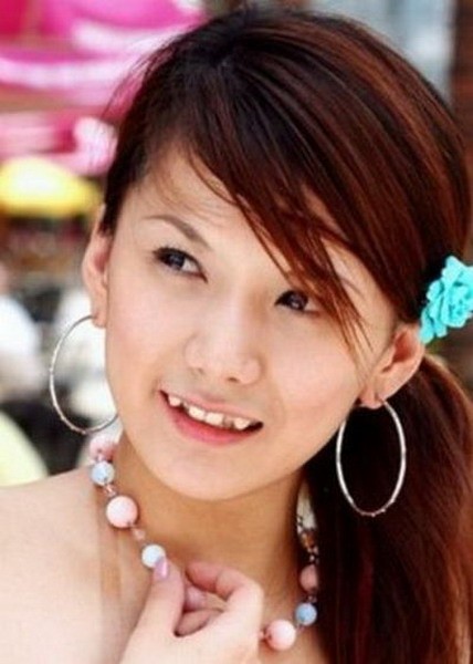 Sự kiện - Teen Nhật rộ mốt gắn răng nanh ma cà rồng (Hình 5).