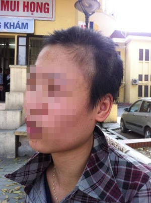 Ph&aacute;p luật - Cạo đầu b&ocirc;i v&ocirc;i vợ v&igrave; qu&aacute; y&ecirc;u?!