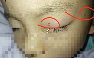 Chú chó liều mình tử chiến với rắn hổ mang để cứu chủ và cái kết- Ảnh 2.